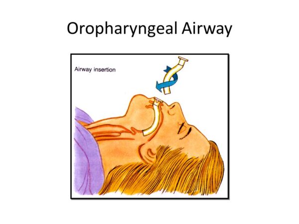 ORAL AIRWAY - Image 3